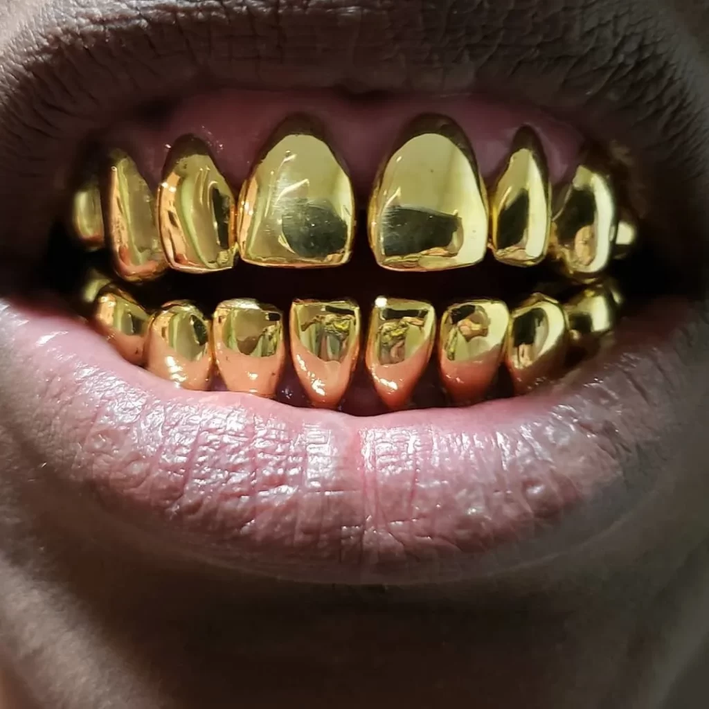 آبکاری طلا روش آلیاژی دندان طلا